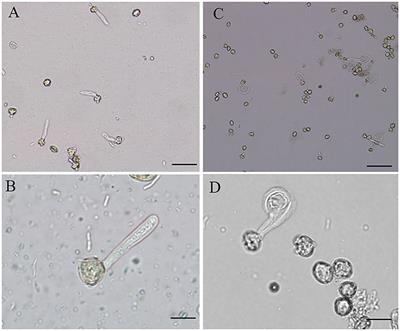 Effect of boron toxicity on pollen tube cell wall architecture and the relationship of cell wall components of Castanea mollissima Blume